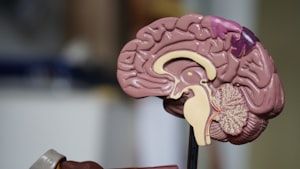 Botox injection for migraine treatment